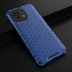 Ultra-thin Silicone Gel Soft Case 360 Degrees Cover C03 for Xiaomi Mi 11 Lite 4G Blue