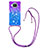 Silicone Candy Rubber TPU Bling-Bling Soft Case Cover with Lanyard Strap S01 for Xiaomi Mi 10i 5G