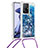 Silicone Candy Rubber TPU Bling-Bling Soft Case Cover with Lanyard Strap S03 for Xiaomi Mi 11T Pro 5G