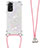 Silicone Candy Rubber TPU Bling-Bling Soft Case Cover with Lanyard Strap YB1 for Xiaomi Redmi Note 11 4G (2022)